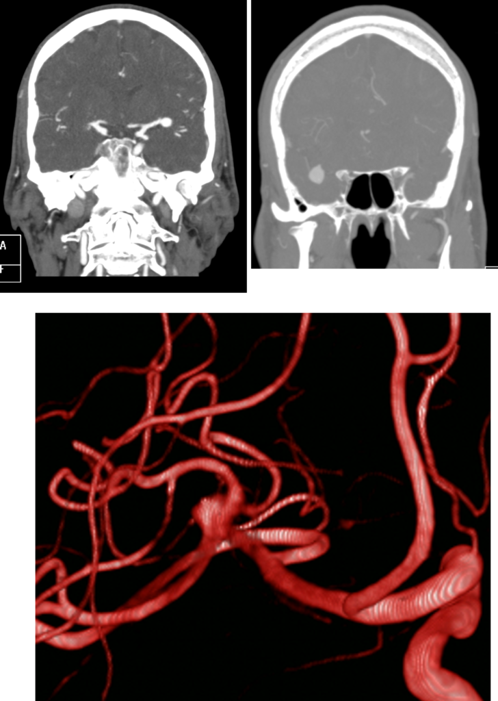 Immagini di accertamenti diagnostici per la diagnosi