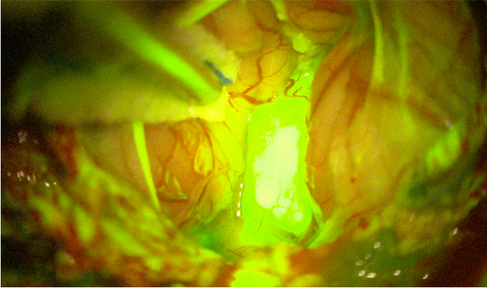 Immage di un dettaglio evidenziato con Fluorescenza con fluoresceina