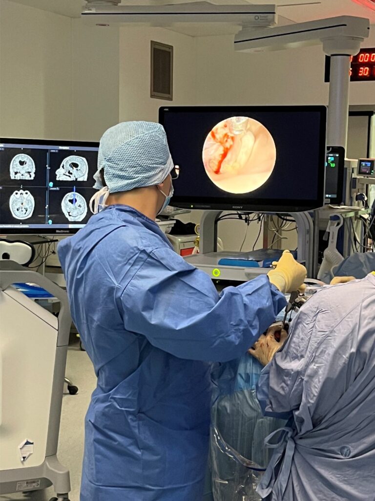 Immagine di un intervento con utilizzo di Endoscopia Cerebrale nel centro del Prof. Alessandro Della Puppa