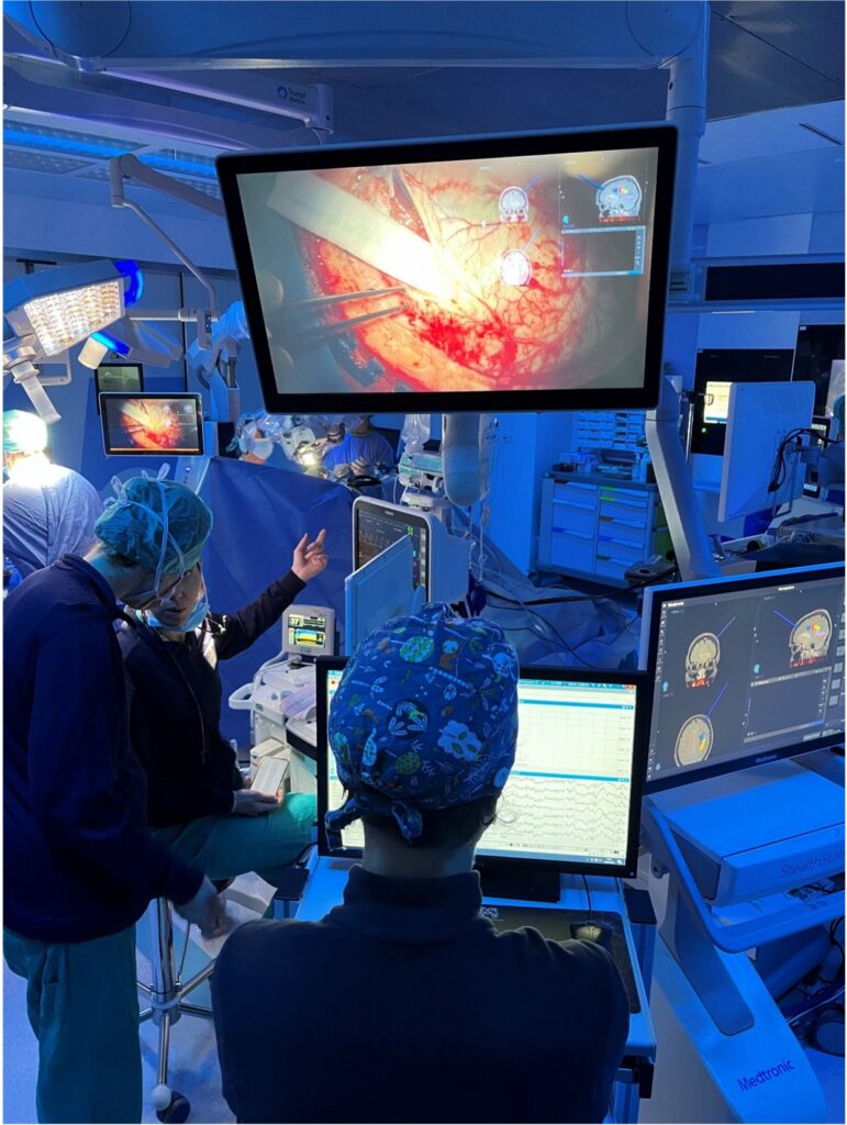 Immagine di un Monitoraggio-Neurofisiologico-Intra-Operatorio del Prof. Alessandro Della Puppa